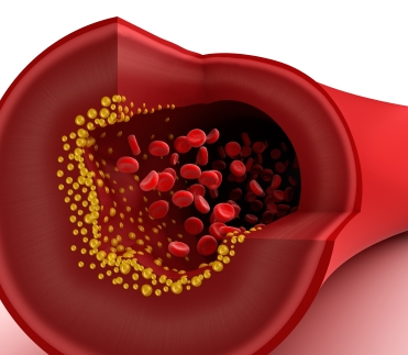 https://www.info-on-high-blood-pressure.com/High-Blood-Pressure-Readings.html