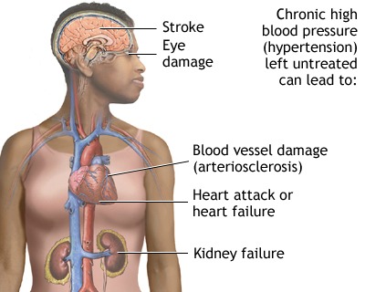 Health concerns of African heritage. https://www.info-on-high-blood-pressure.com/African-Americans-and-high-blood-pressure.html